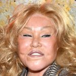 Jocelyn Wildenstein suffered from pulmonary embolism caused by phlebitis at the time of her death