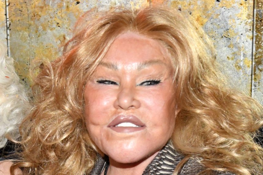 Jocelyn Wildenstein suffered from pulmonary embolism caused by phlebitis at the time of her death