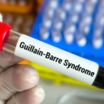 Mumbai records first death due to Guillain-Barré Syndrome (GBS)