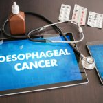 Oesophageal Cancer Awareness Month: Signs your sore throat needs medical attention