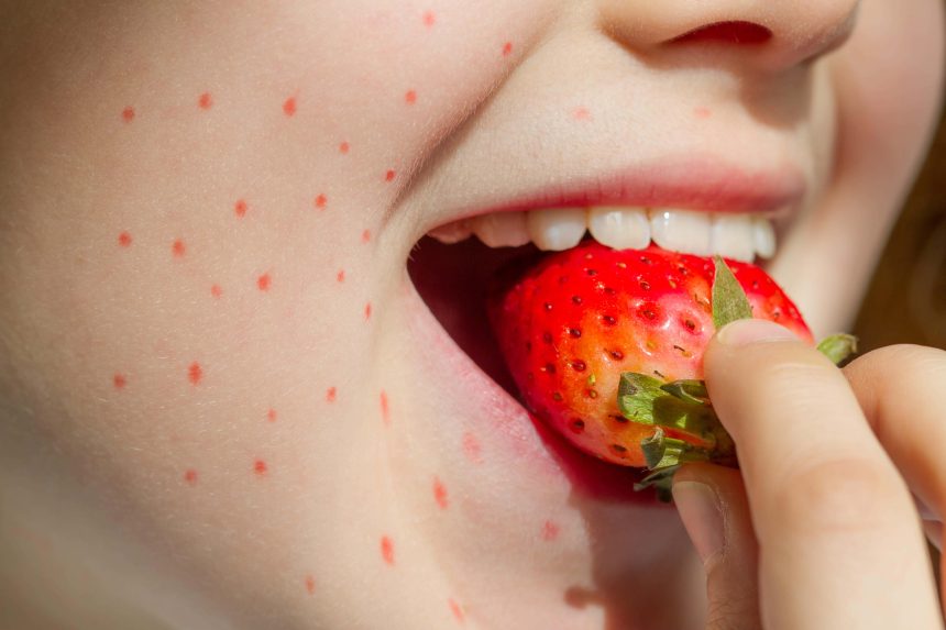 Red, itchy, raised spots can be a sign of an allergic reaction (Alamy/PA)